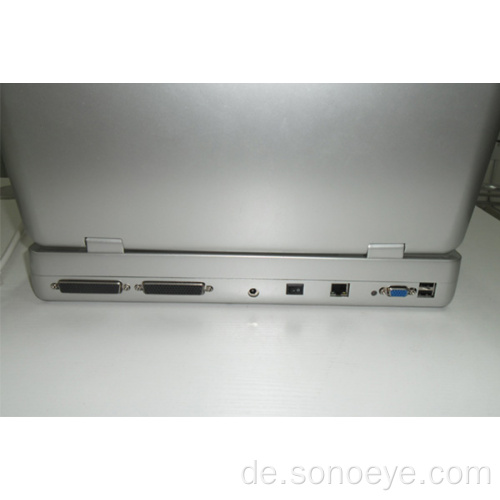 PC-basierter Ultraschall-Maschinen-Laptop-Ultraschall SS-9